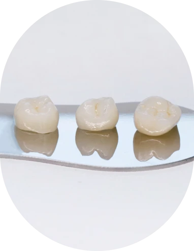 Dental Crowns Treatment - Dr. Sonia Herrera