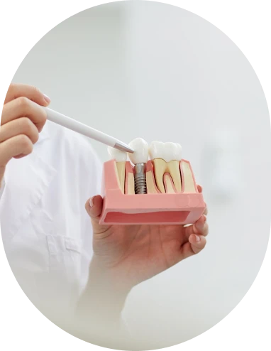 Dental Implant Treatment - Dr. Sonia Herrera